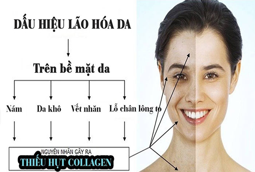 Cơ thể thiếu collagen có những dấu hiệu gì