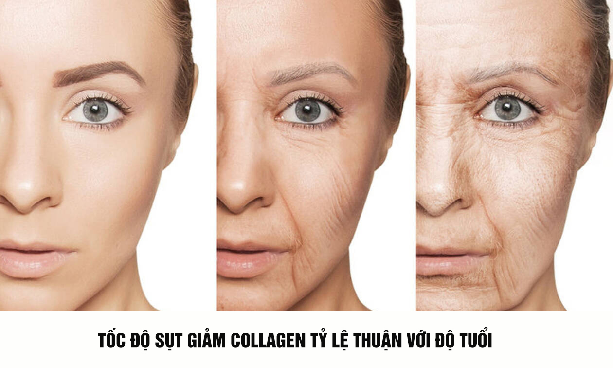 ốc độ sụt giảm collagen sẽ tỷ lệ thuận với độ tuổi